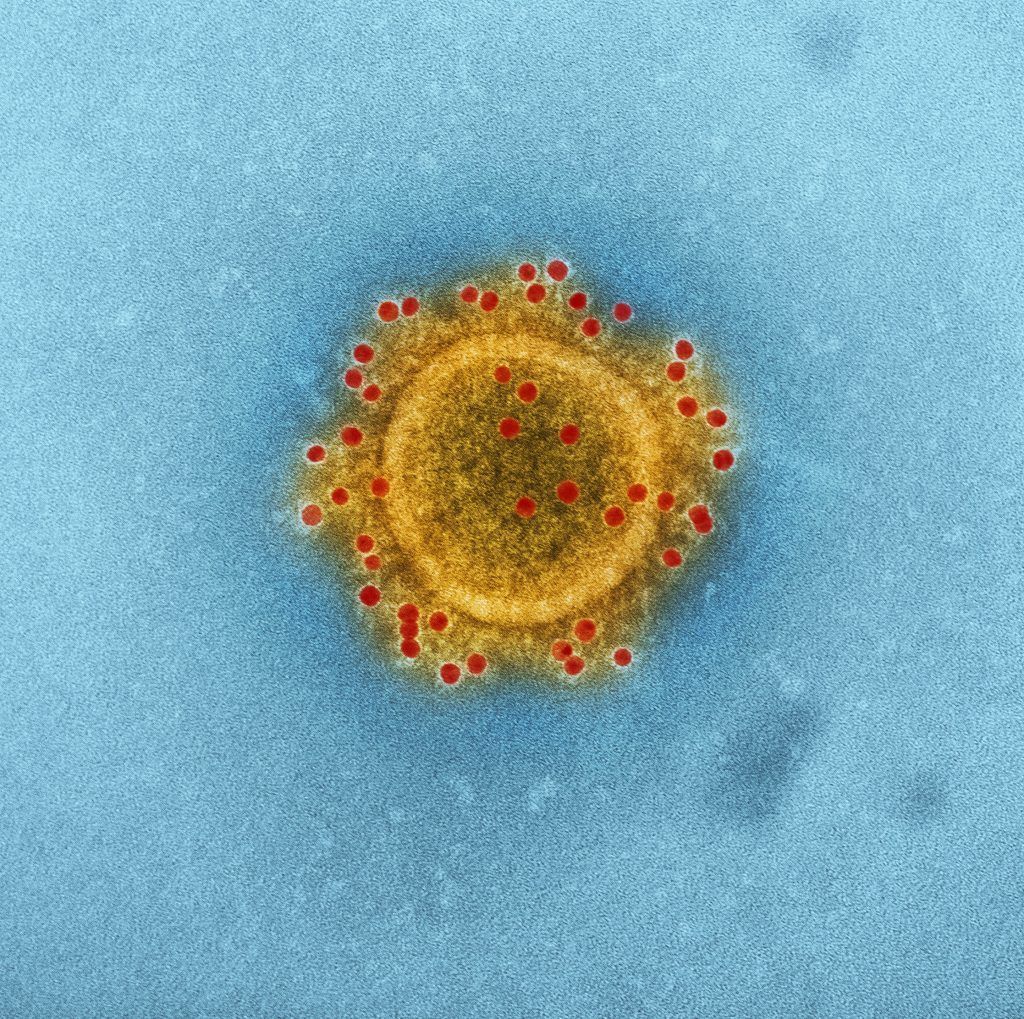 Coronavirus a vista de microscropio